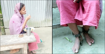 উন্নত চিকিৎসা পেলেই শিকল থেকে মুক্তি পেতে পারেন সুলতানা