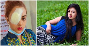 কন্টাক্ট লেন্স গলে ক্ষতিগ্রস্ত নায়িকার চোখ