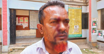 প্রধান শিক্ষককে পেটালেন সহকারী শিক্ষক