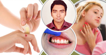 ভিটামিন সি কেন গুরুত্বপূর্ণ?