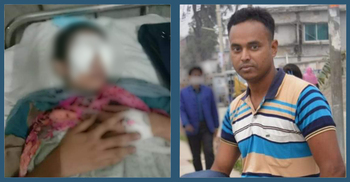 যৌতুক না পেয়ে গৃহবধূর চোখ উৎপাটনের চেষ্টা