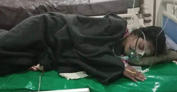 পেটে কাঁচি রেখে সেলাইয়ের ঘটনা তদন্তে কমিটি