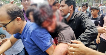 Over 200 students of Dhaka College hurt during clashes