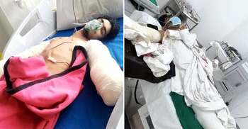 দুর্ঘটনায় হাত হারিয়ে হাসপাতালের বেডে হায়দার, বাঁচাতে বাবার আকুতি