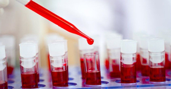 Rare case of woman's body ridding itself of HIV