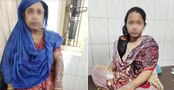 মেয়ের গায়ে আগুন দিল বখাটে, বাঁচাতে গিয়ে ঝলসে গেল মাও