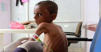 Yemen's children starve amid rising fears of famine