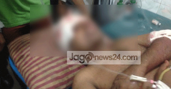 College teacher hacked in Madaripur