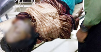 থানার বাইরে গায়ে আগুন দেয়া সেই তরুণীর মৃত্যু