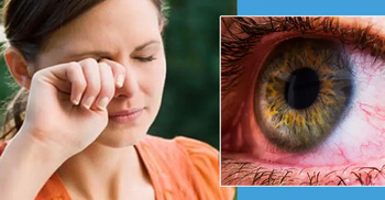 অ্যালার্জি ও চোখের সংক্রমণের মধ্যে পার্থক্য কী?