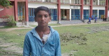 আদর করতে গিয়ে হনুমানের হামলায় আহত স্কুলছাত্র