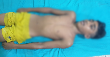 নারায়ণগঞ্জে লেকে গোসল করতে নেমে কিশোরের মৃত্যু