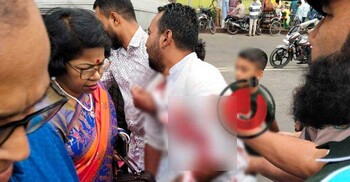 ঈদ আনন্দে ঘুরতে এসে ব্লেড দিয়ে আত্মহত্যার চেষ্টা যুবকের!