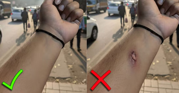 এআই দিয়ে ‘আহত হাতের’ ছবি বানিয়ে অফিস থেকে ছুটি নিলেন কর্মী