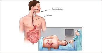 এন্ডোস্কপি করলে কি রোজা ভেঙে যায়?
