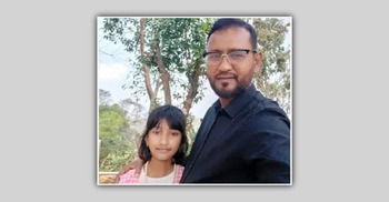 বার্ন ইনস্টিটিউটে আলবীরা, উৎকণ্ঠায় দিন কাটছে বাবার