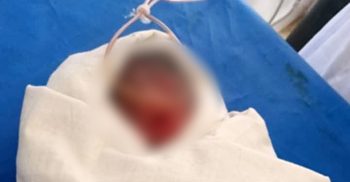 হাসপাতালের বাথরুমে মিললো নবজাতক