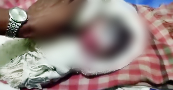নালায় মিললো নবজাতক, মুখ ক্ষতবিক্ষত করেছে পোকামাকড়