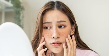 মেছতা হালকা করার ঘরোয়া উপায়