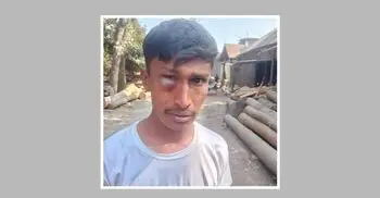 জামায়াতের নির্বাচনি প্রচারণায় বাধা, ভ্যানচালকের চোখে গুরুতর আঘাত