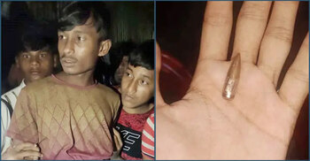 Gunfire from Myanmar injures Rohingya youth in Ukhiya