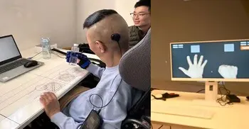 পক্ষাঘাত চিকিৎসায় ‘ব্রেইন–কম্পিউটার’ ইন্টারফেসের ক্লিনিক্যাল অনুমোদন