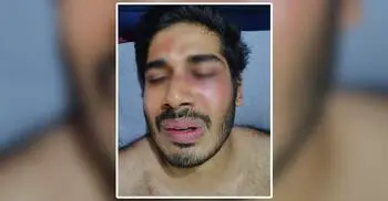 অতিরিক্ত ভাড়া চাওয়ার প্রতিবাদ করায় চবি শিক্ষার্থীকে মারধর