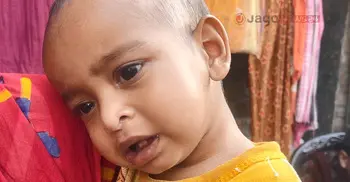ঘরে ঘরে উপসর্গ নিয়ে ঘুরছে শিশুরা, উদাসীনতায় বাড়ছে হাম