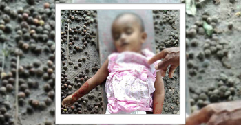 প্রাইভেটকারের ধাক্কা, মায়ের কোল থেকে ছিটকে প্রাণ গেলো শিশুর