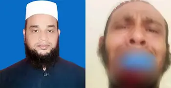 অধ্যক্ষের ঘুসিতে দুই দাঁত হারালেন কম্পিউটার অপারেটর