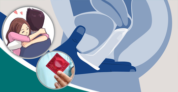 জন্মনিয়ন্ত্রণ সামগ্রীর দাম বাড়ায় কমছে ব্যবহার