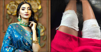 শুটিং সেটে আহত অভিনেত্রী সুনেরাহ