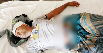 পোস্টার লাগানোর সময় স্বতন্ত্র প্রার্থীর সমর্থককে কুপিয়ে জখম