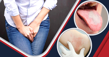 শীতে বাড়ে ছত্রাক সংক্রমণ, কোন লক্ষণে সতর্ক হবেন?