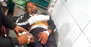 গাইবান্ধায় দুর্বৃত্তদের হামলায় যুবদল কর্মীর আঙুল বিচ্ছিন্ন