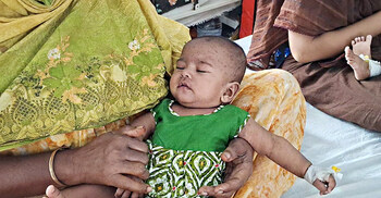 গাজীপুরে তিনদিনে হামে আক্রান্ত হয়ে হাসপাতালে ২৭ শিশু