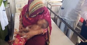 অস্ত্রোপচারে অপসারণ করা হলো শিশুর ভেতর জন্ম নেওয়া আরেক শিশু