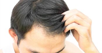 5 effective tips to stimulate hair regrowth