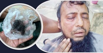 ফেনীতে জামায়াত কর্মীকে পিটিয়ে দাড়ি উপড়ে দিলেন বিএনপি কর্মীরা