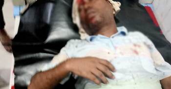 কোনাবাড়িতে ঝুট ব্যবসা নিয়ে বিএনপির দুই গ্রুপে সংঘর্ষ