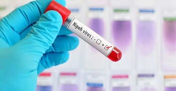 পশ্চিমবঙ্গে নিপাহ ভাইরাসের খোঁজ