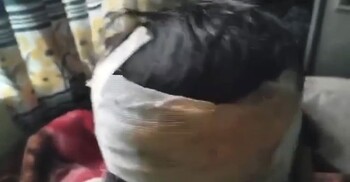 কদমতলীতে গণসংযোগে জামায়াত নেত্রীর মাথায় কোপ