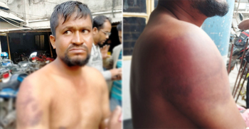 হাতকড়া পরিয়ে রিকশাচালককে ৫ ঘণ্টা নির্যাতনের অভিযোগ