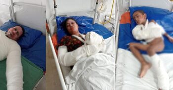 দরজা আটকে মেম্বারের ঘরে আগুন, শিশুসহ দগ্ধ ৪