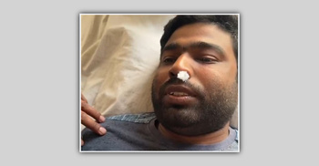 ‘তুই মালায়ন মানুষ, ধানের শীষে ভোট দিবি ক্যান’ বলে মারধরের অভিযোগ