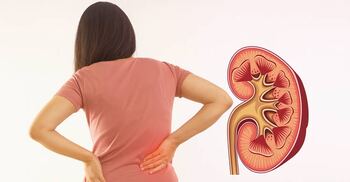 শীতের সময়ে কিডনিতে পাথর জমার ঝুঁকি বাড়ে