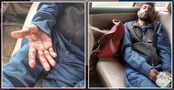 মিরসরাইয়ে স্বতন্ত্র প্রার্থীর পক্ষে কাজ করায় হামলা