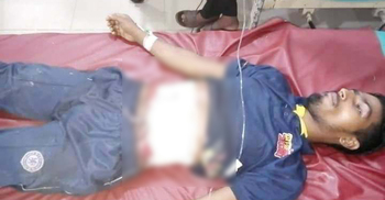 পাগলা মহিষ ধরতে পুলিশের গুলি, যুবক আহত