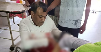 নাটোরে আ’লীগের হামলায় বিএনপি নেতা রক্তাক্ত