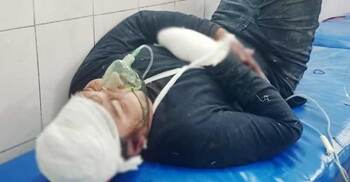 অভিযানে র‌্যাবের ৩ সদস্যকে কুপিয়ে আসামি ছিনতাই